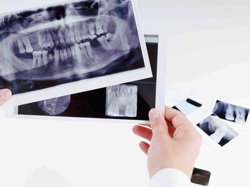 Dentysta Toruń - RTG zęba - gabinet stomatologiczny