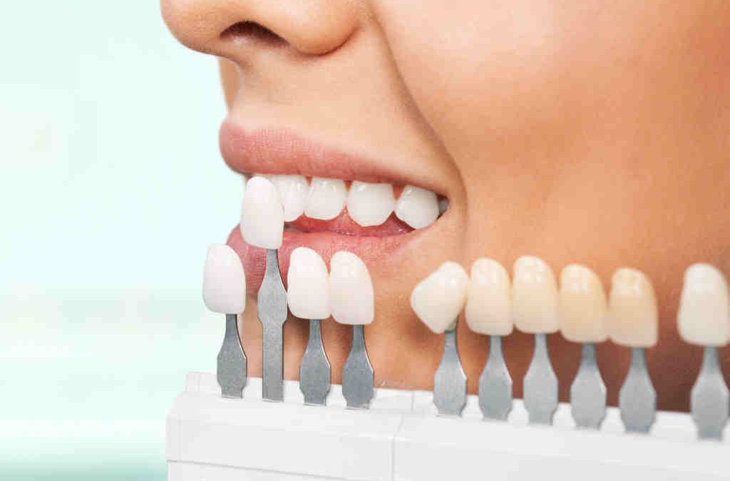 Stomatologia estetyczna -gabinet stomatologiczny klinika pięknego uśmiechu